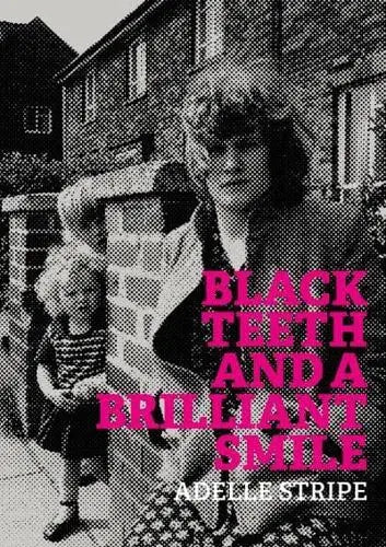 Black Teeth and a Brilliant Smile- Adelle Stripe
